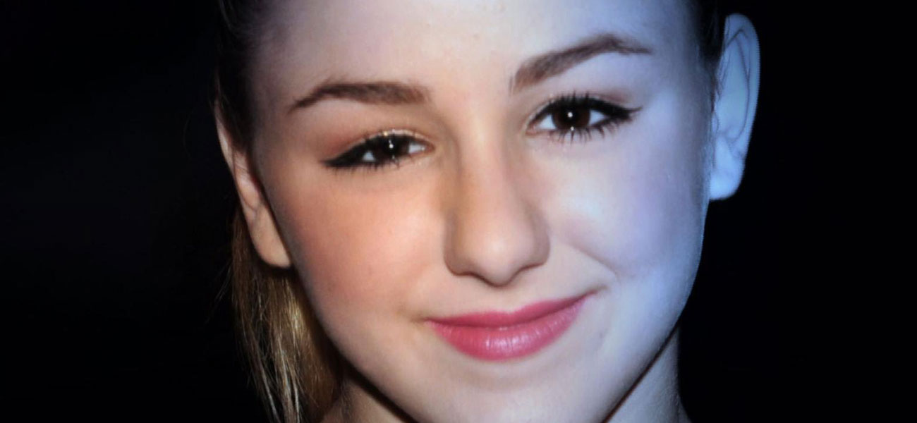 Sessiz Sinüs Sendromu (Silent Sinus Syndrome)