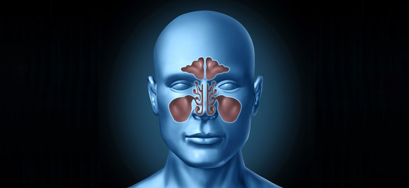 Odontojenik Sinüzit: Diş Kaynaklı Sinüs Enfeksiyonu