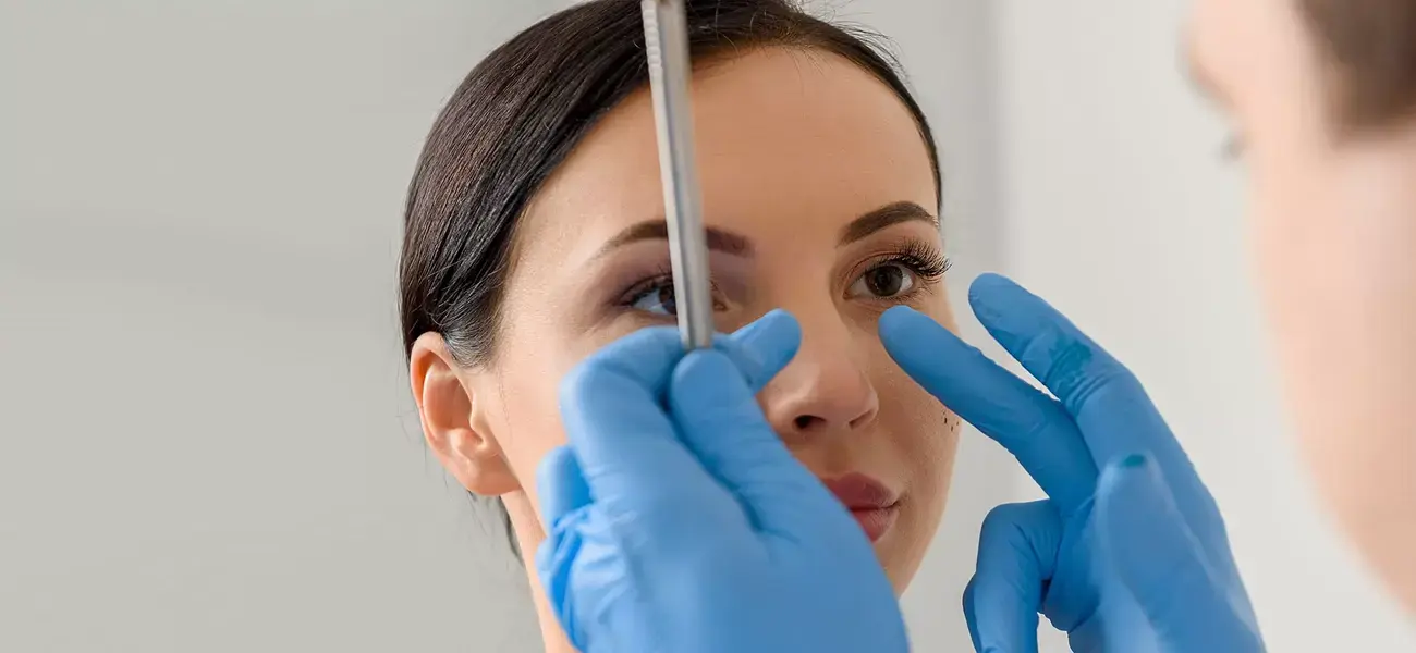 Septum Perforasyonu (Burun İçi Delik) Cerrahi Tedavisi (Onarımı)